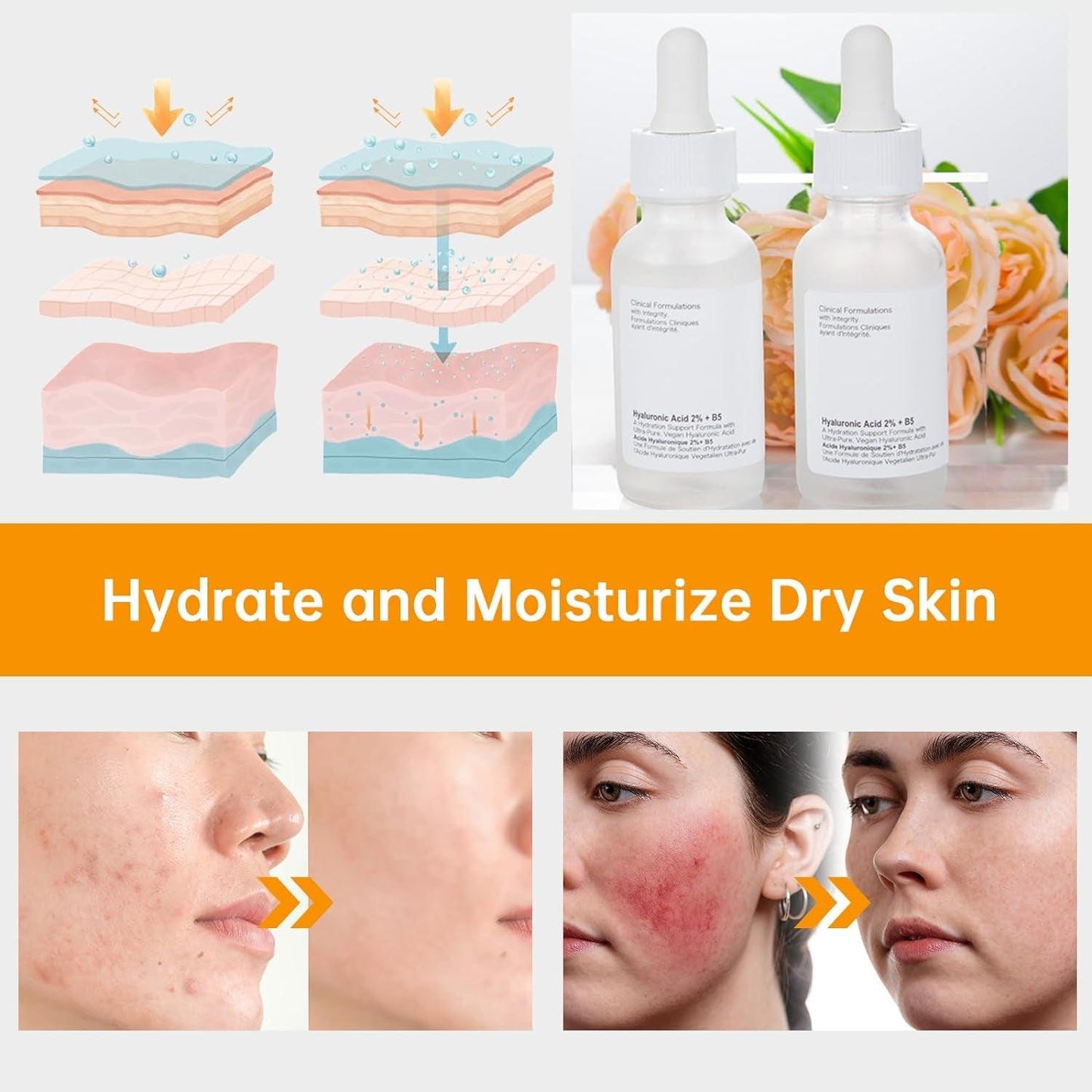 Hyaluronic Acid 2% + B5 Facial Serum, 30ML Hyaluronic Acid Serum for Face, 1 Floz Hyaluronic Acid Serum, Hyaluronic Acid and Vitamin B5, Moisturizing. - Jazz Beauty