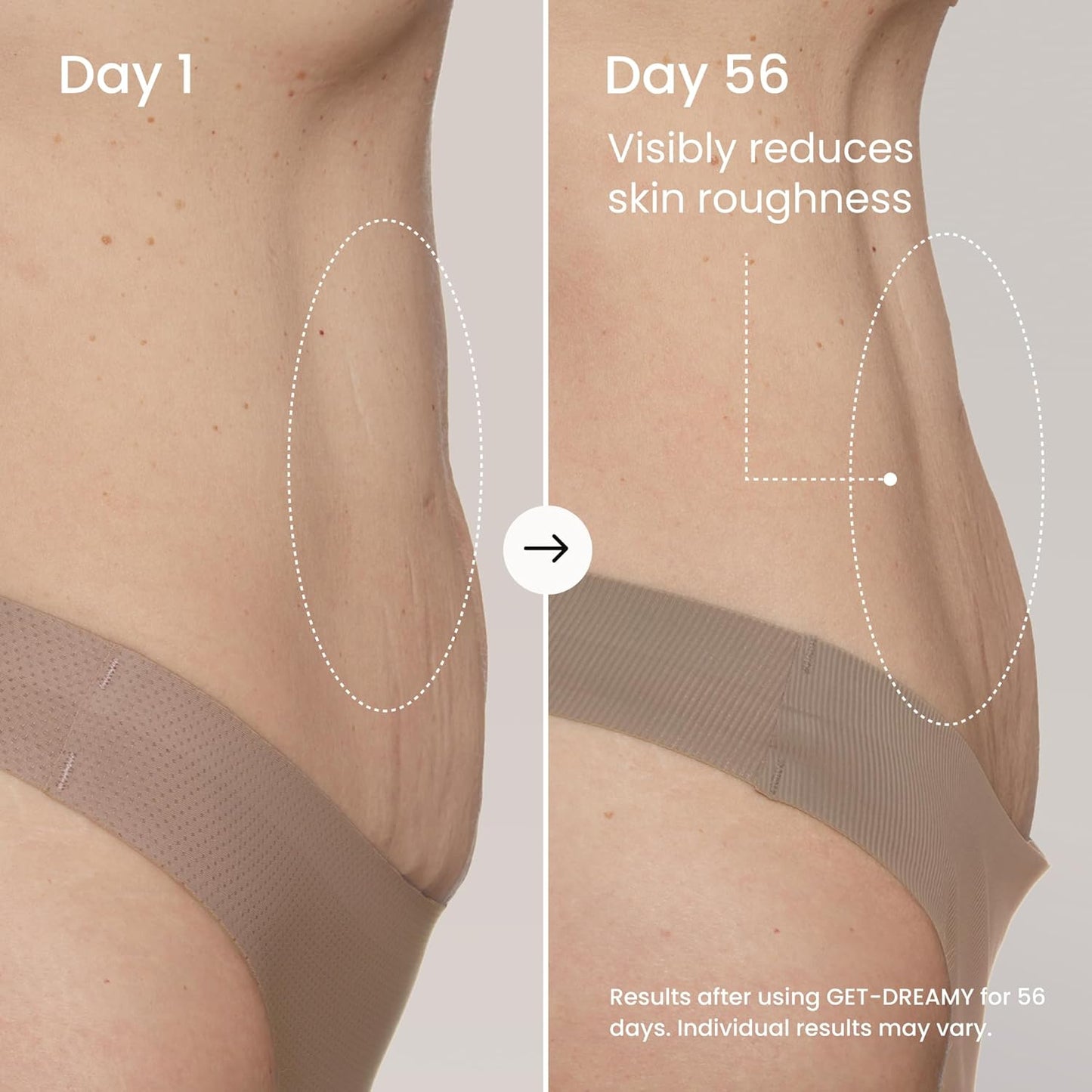 GET-DREAMY Overnight Toning Whip - Cellulite Cream & Skin Tightening Support with Milk Thistle + Uva-Ursi - Moisturizing Body Cream in a Whipped Texture (6.8 Fl Oz)